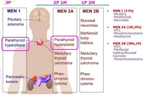 Men's 1/2